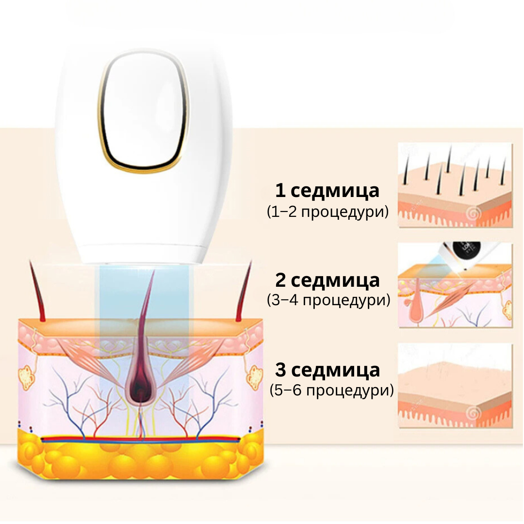 Glowie™ IPL фотоепилатор – Уред за премахване на окосмяване