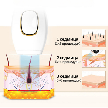 Glowie™ IPL фотоепилатор – Уред за премахване на окосмяване